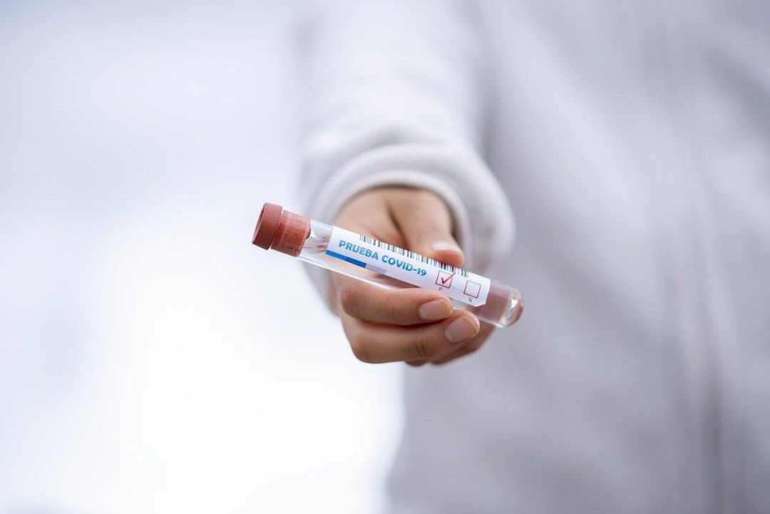 Prueba PCR. Prueba PCR.