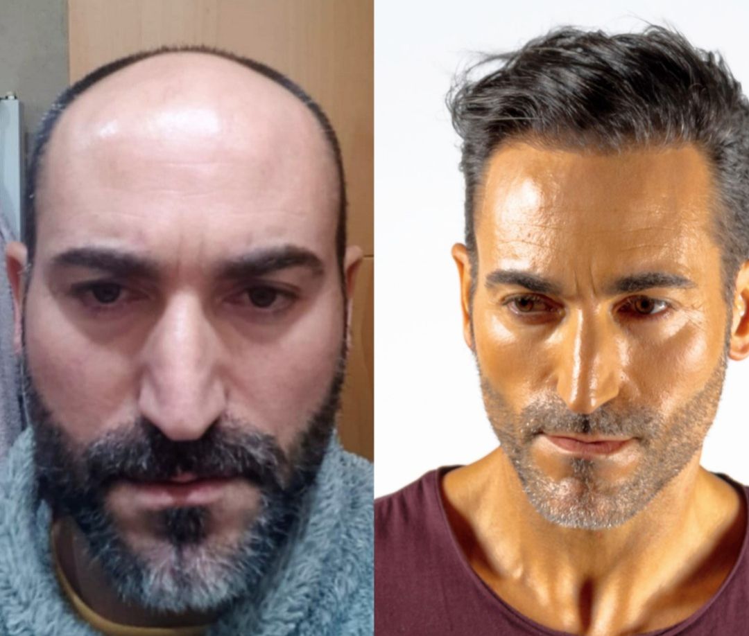 El antes y el después de un tratamiento El antes y el después de un tratamiento
