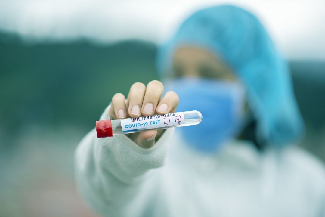 Els residents tindran més senzill viatjar des de la península en haver molts més laboratoris on fer-se una PCR de forma gratuïta. Els residents tindran més senzill viatjar des de la península en haver molts més laboratoris on fer-se una PCR de forma gratuïta.