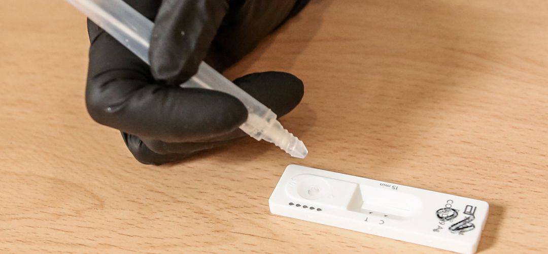 Material necesario para la realización de test de antígenos en un dispositivo organizado por la Comunidad de Madrid para la detección del COVID-19 en policías locales, miembros de Protección Civil, Bomberos, Agentes Forestales y gestores del 112 Material necesario para la realización de test de antígenos en un dispositivo organizado por la Comunidad de Madrid para la detección del COVID-19 en policías locales, miembros de Protección Civil, Bomberos, Agentes Forestales y gestores del 112