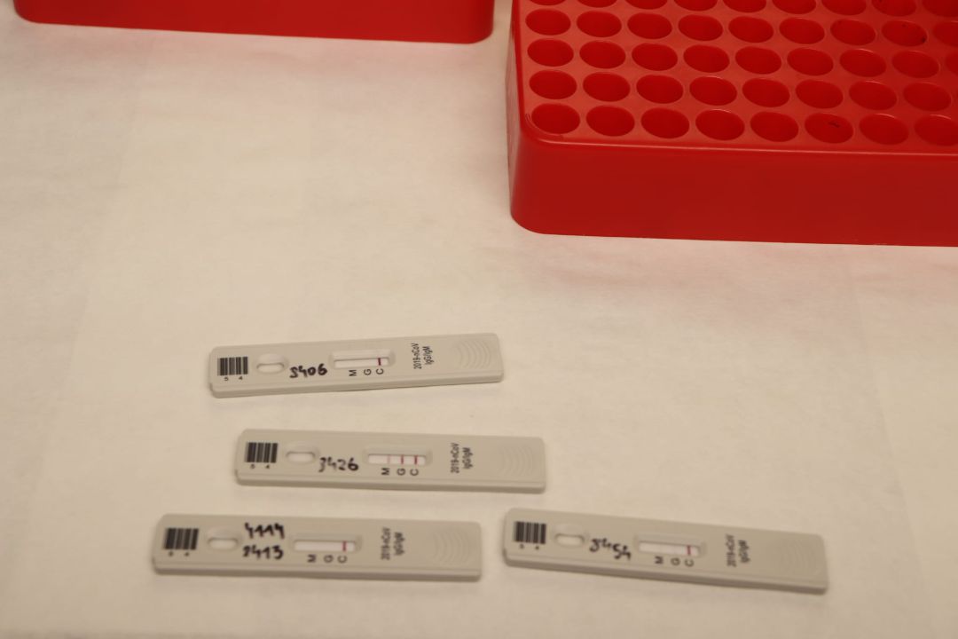 Las Pitiusas han sumado 28 postivos más por coronavirus Las Pitiusas han sumado 28 postivos más por coronavirus