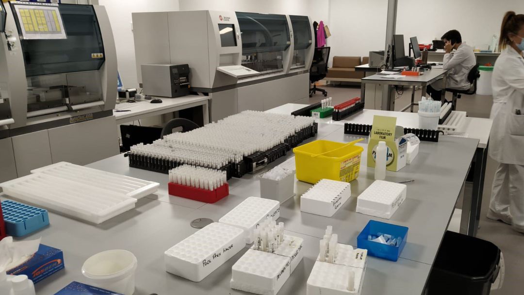 Muestras para la realización de pruebas PCR de COVID-19, mediante el sistema de 'pooling', en el área sanitaria de Vigo. Muestras para la realización de pruebas PCR de COVID-19, mediante el sistema de 'pooling', en el área sanitaria de Vigo.