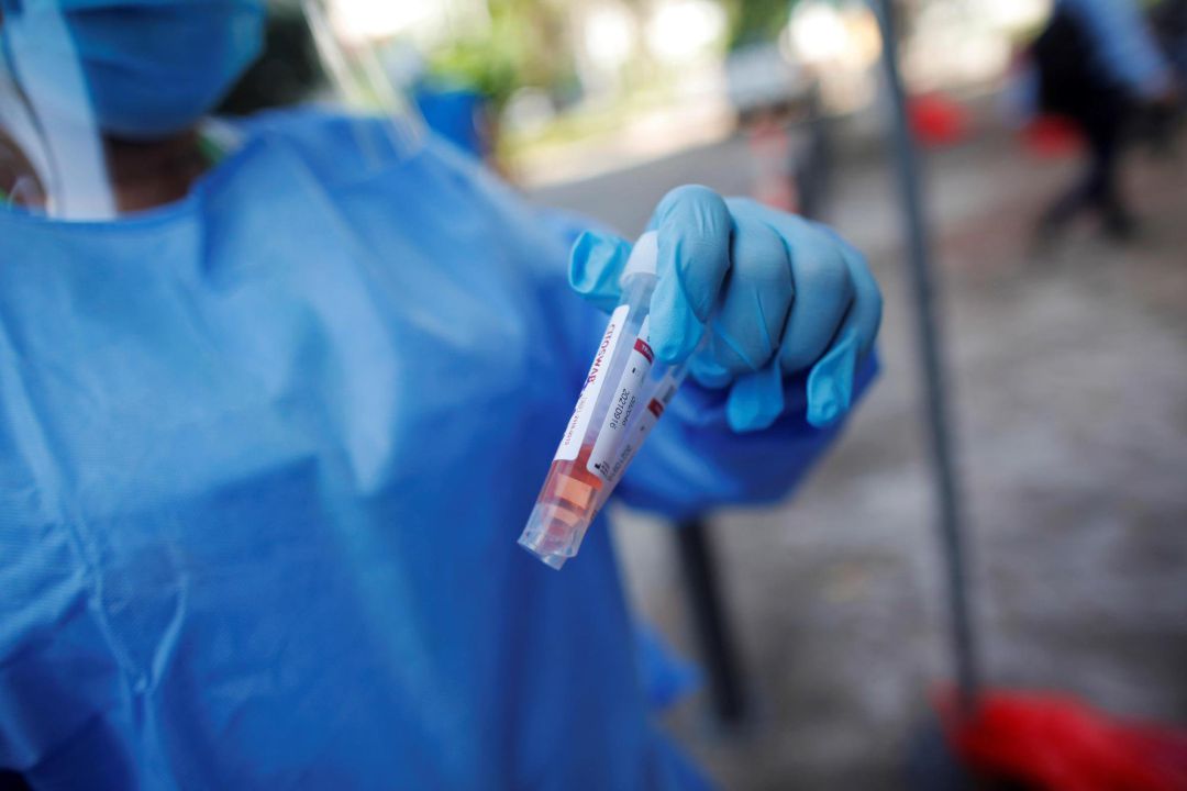 Un sanitario, tras tomar varias muestras para el análisis de posibles infecciones por covid. Un sanitario, tras tomar varias muestras para el análisis de posibles infecciones por covid.