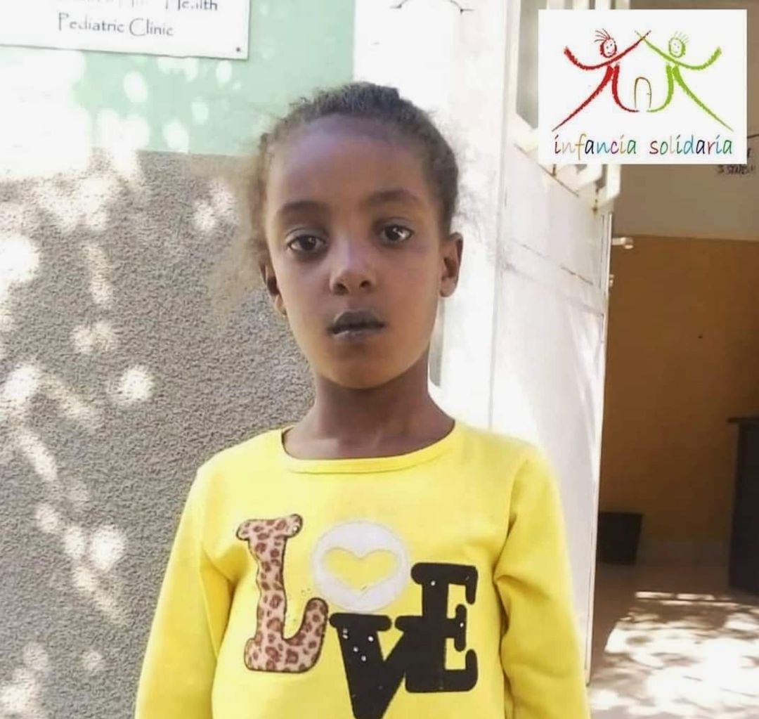 Danisa es una niña etíope que necesita una familia de acogida en Córdoba mientras dura su intervención quirúrgica en el Hospital Reina Sofía Danisa es una niña etíope que necesita una familia de acogida en Córdoba mientras dura su intervención quirúrgica en el Hospital Reina Sofía