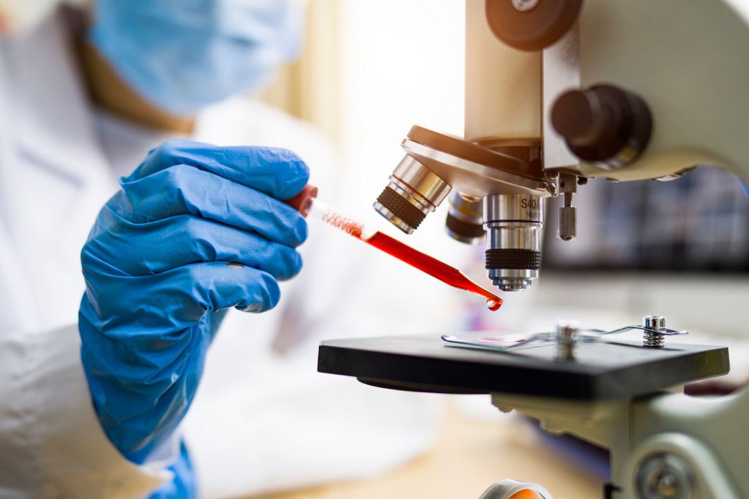 Las pruebas confirman 1.157 positivos de coronavirus en L'Alcoià y El Comtat. Las pruebas confirman 1.157 positivos de coronavirus en L'Alcoià y El Comtat.