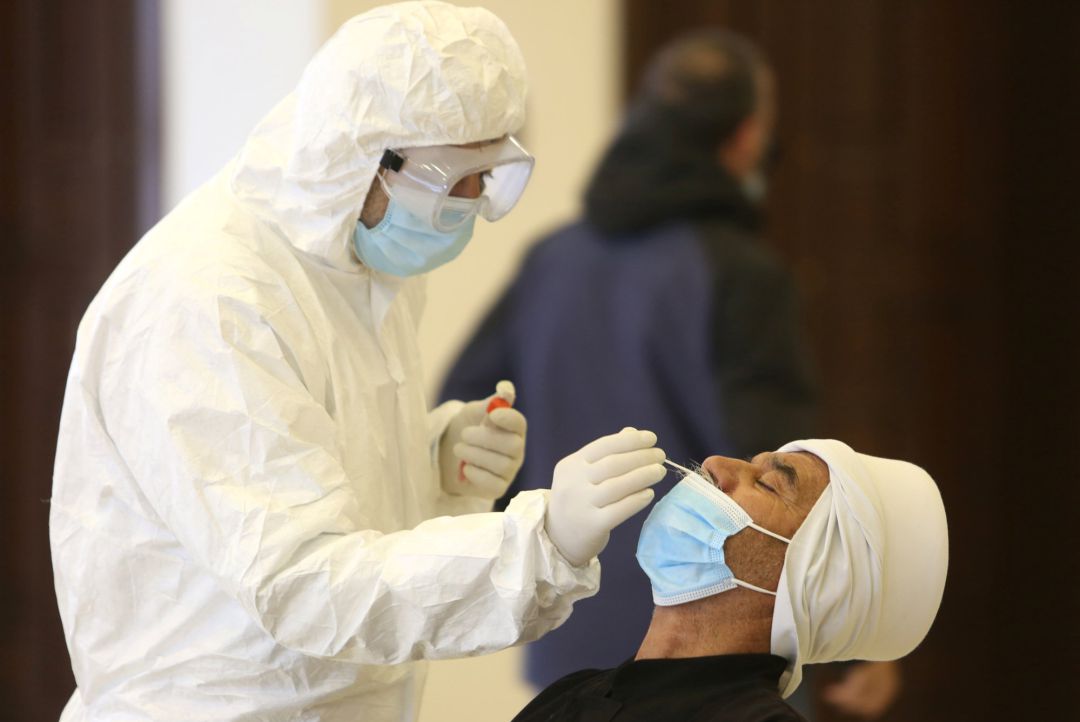 Prueba de coronavirus Prueba de coronavirus