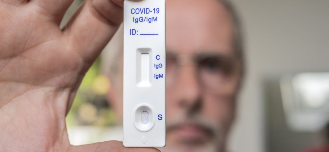 Los test de antígenos ofrecen resultados más rápidos que las PCR. Los test de antígenos ofrecen resultados más rápidos que las PCR.