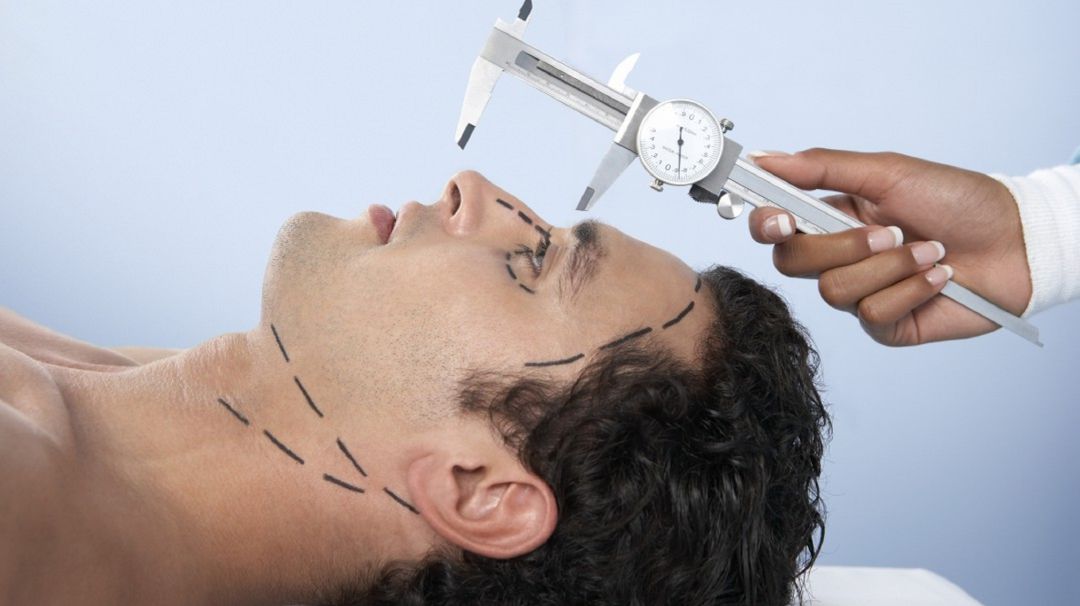 Antes de realizar una rinoplastia Antes de realizar una rinoplastia