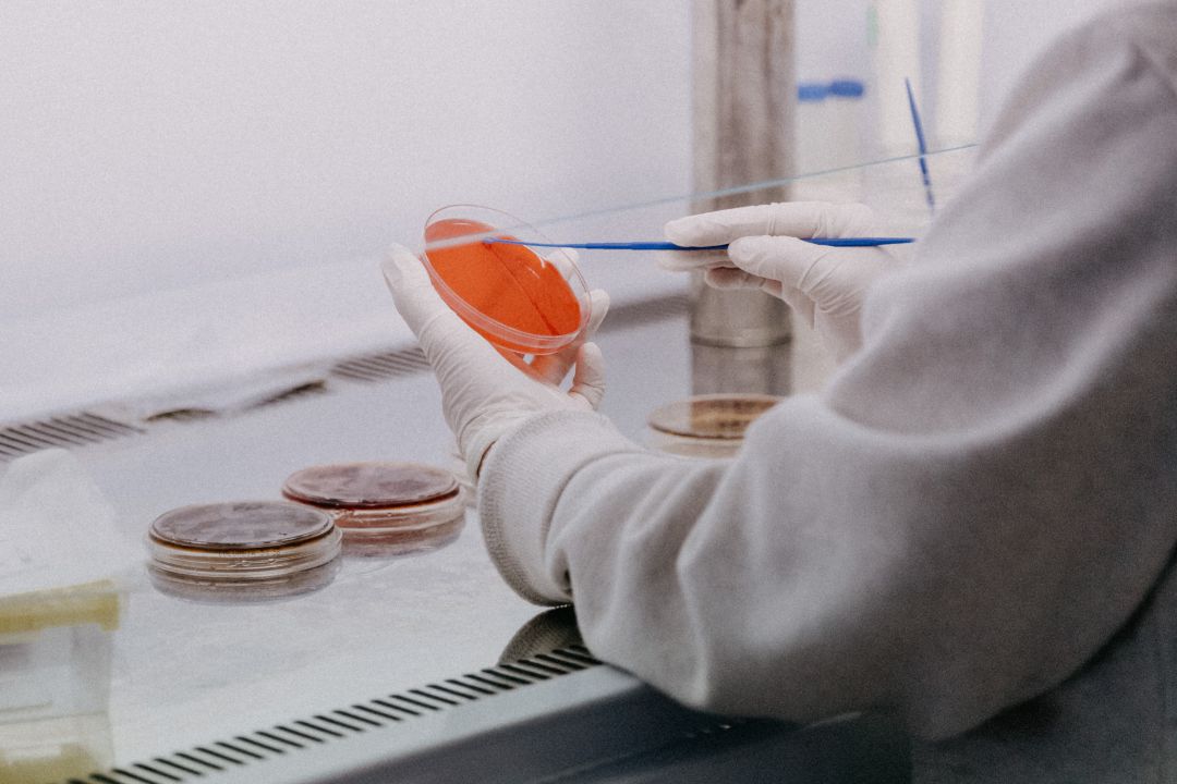 Análisis de una muestra de cultivo en laboratorio Análisis de una muestra de cultivo en laboratorio