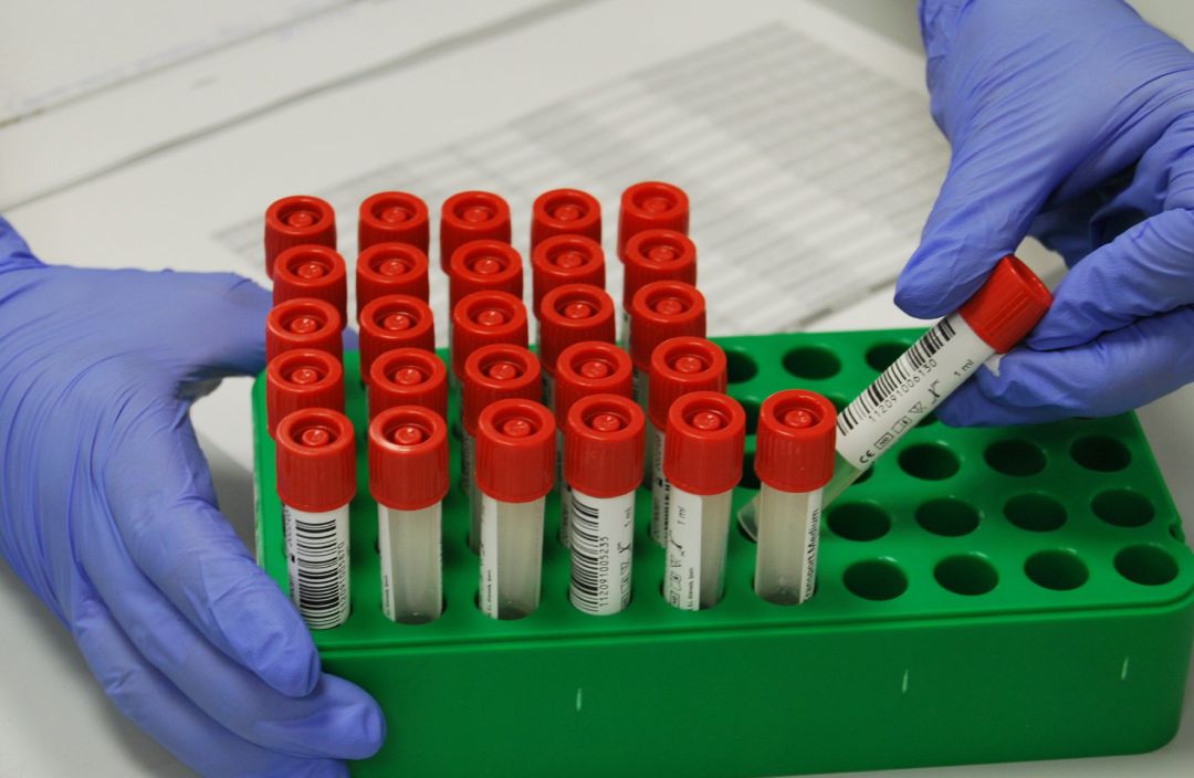 Recogida de muestras en el cribado Recogida de muestras en el cribado