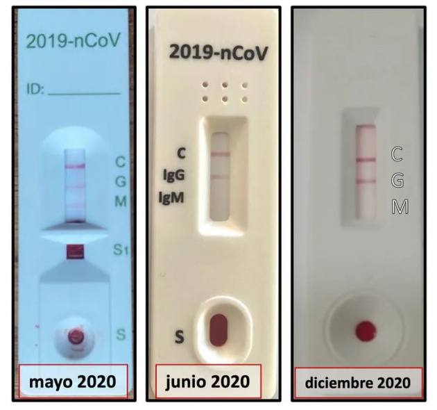 La evolución de los anticuerpos de Asun: la imagen izquierda es del décimo día tras la aparición de síntomas. Se detecta presencia de IgM e IgG. Una vez, recuperada, al mes siguiente de la enfermedad ya sólo se detecta IgG (imagen central), y el pasado mes de diciembre, una semana antes de vacunarse se siguen manteniendo niveles detectables de IgG (imagen derecha) La evolución de los anticuerpos de Asun: la imagen izquierda es del décimo día tras la aparición de síntomas. Se detecta presencia de IgM e IgG. Una vez, recuperada, al mes siguiente de la enfermedad ya sólo se detecta IgG (imagen central), y el pasado mes de diciembre, una semana antes de vacunarse se siguen manteniendo niveles detectables de IgG (imagen derecha)