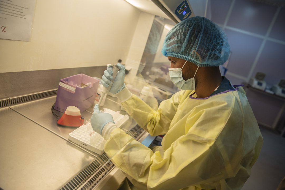 El tratamiento con antivirales es una de las vías de investigación. El tratamiento con antivirales es una de las vías de investigación.