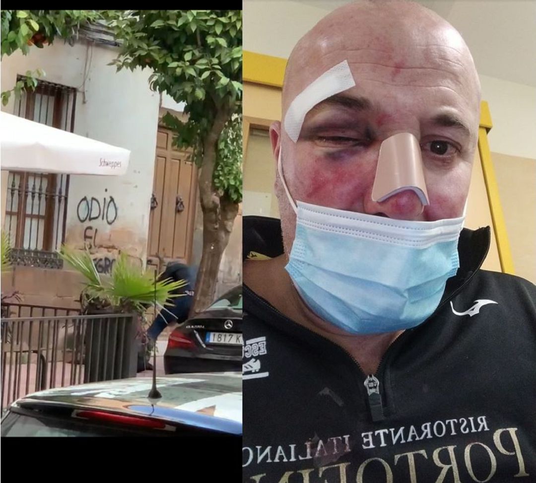 Captura de la agresión y víctima en el hospital San Agustín de Linares. Captura de la agresión y víctima en el hospital San Agustín de Linares.