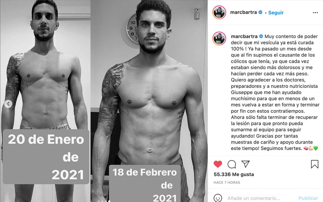 Bartra publica su estado físico en Instagram. Bartra publica su estado físico en Instagram.