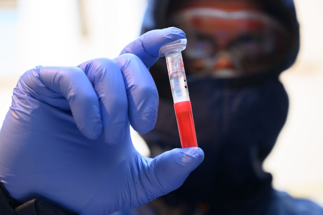 Un sanitario con una muestra de una prueba PCR. Un sanitario con una muestra de una prueba PCR.