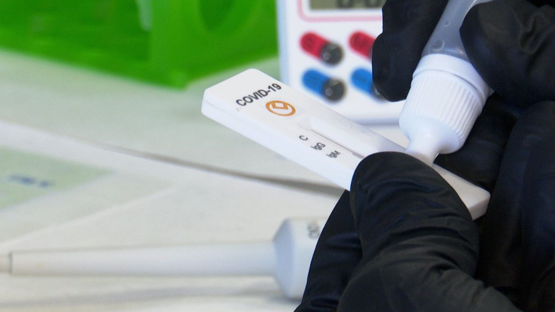 Un laboratorio valenciano desarrolla un test rápido de detección de anticuerpos con un 98% de efectividad
Un laboratorio valenciano desarrolla un test rápido de detección de anticuerpos con un 98% de efectividad