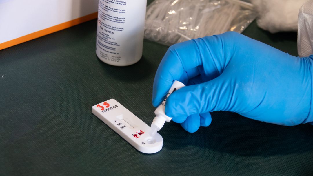 Mesa con pruebas de anticuerpos de detección del coronavirus COVID-19 Mesa con pruebas de anticuerpos de detección del coronavirus COVID-19