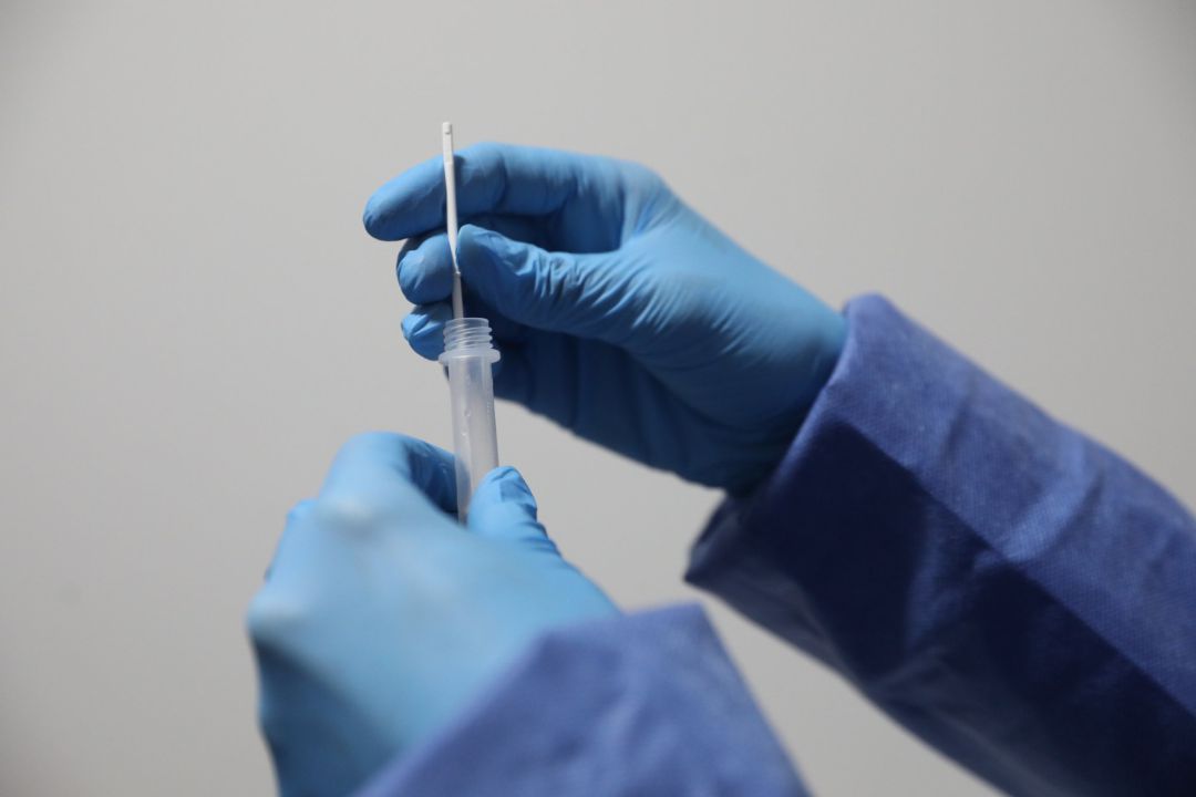 Un sanitario sostiene una probeta tras realizar un test de antígenos. Un sanitario sostiene una probeta tras realizar un test de antígenos.