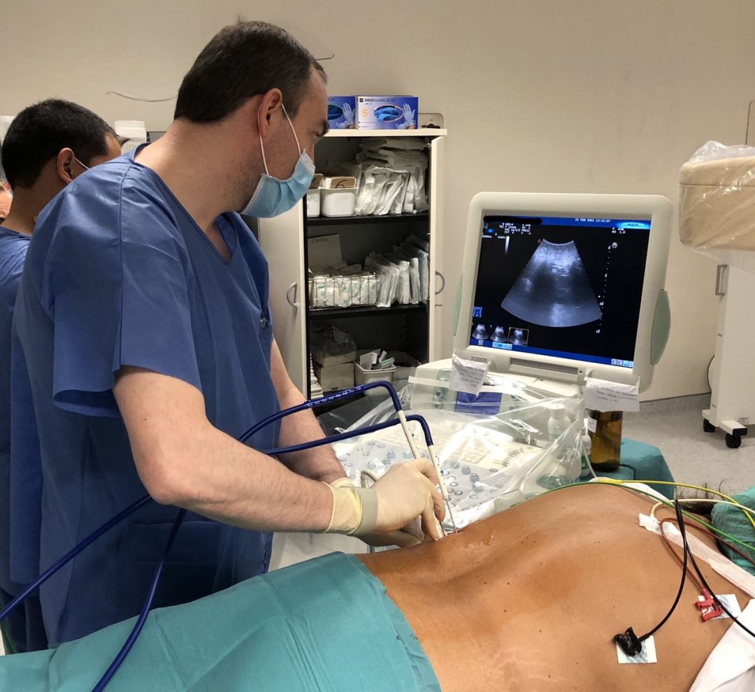 El Hospital Universitario de Burgos trata tumores renales de difícil acceso mediante crioablación El Hospital Universitario de Burgos trata tumores renales de difícil acceso mediante crioablación