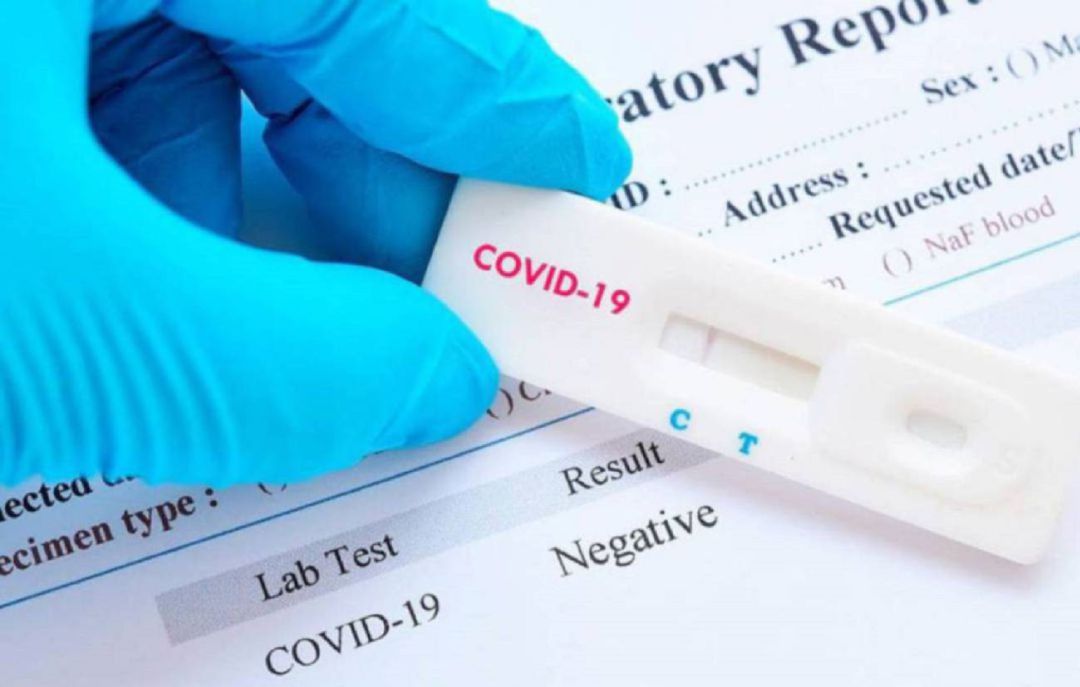Prueba de coronavirus Prueba de coronavirus