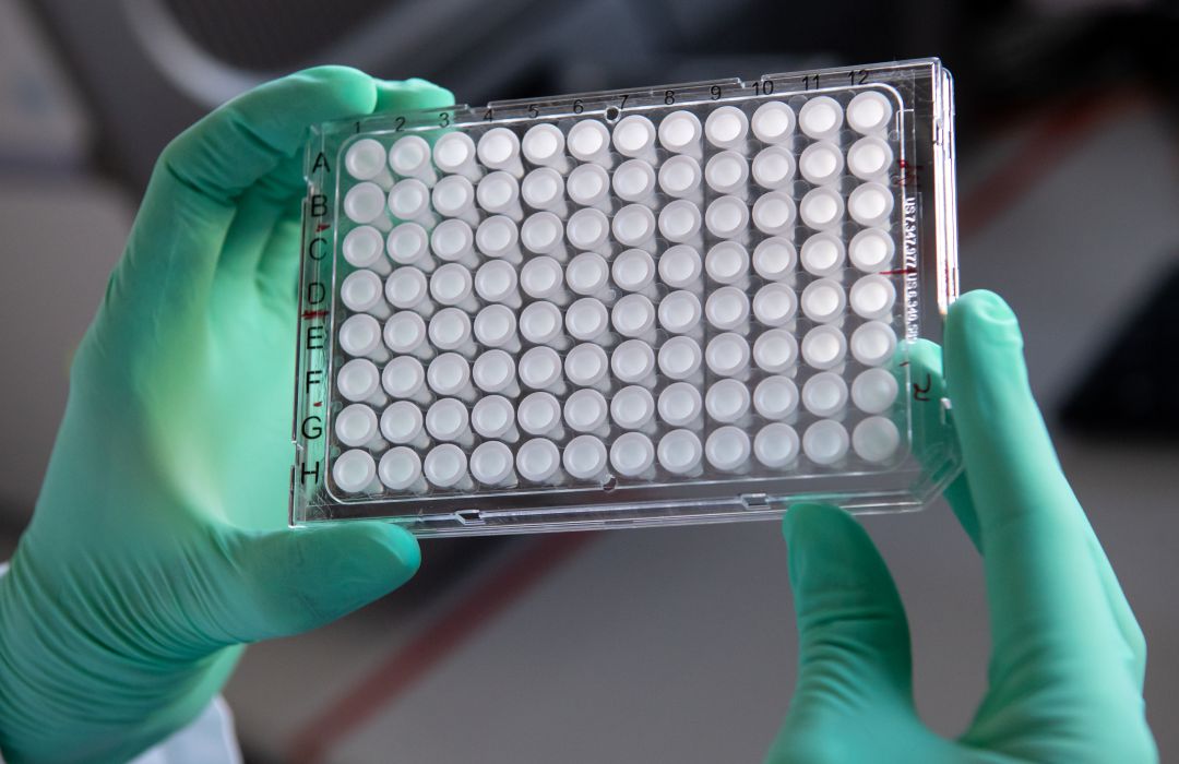 Varias muestras de PCR en un laboratorio. Varias muestras de PCR en un laboratorio.