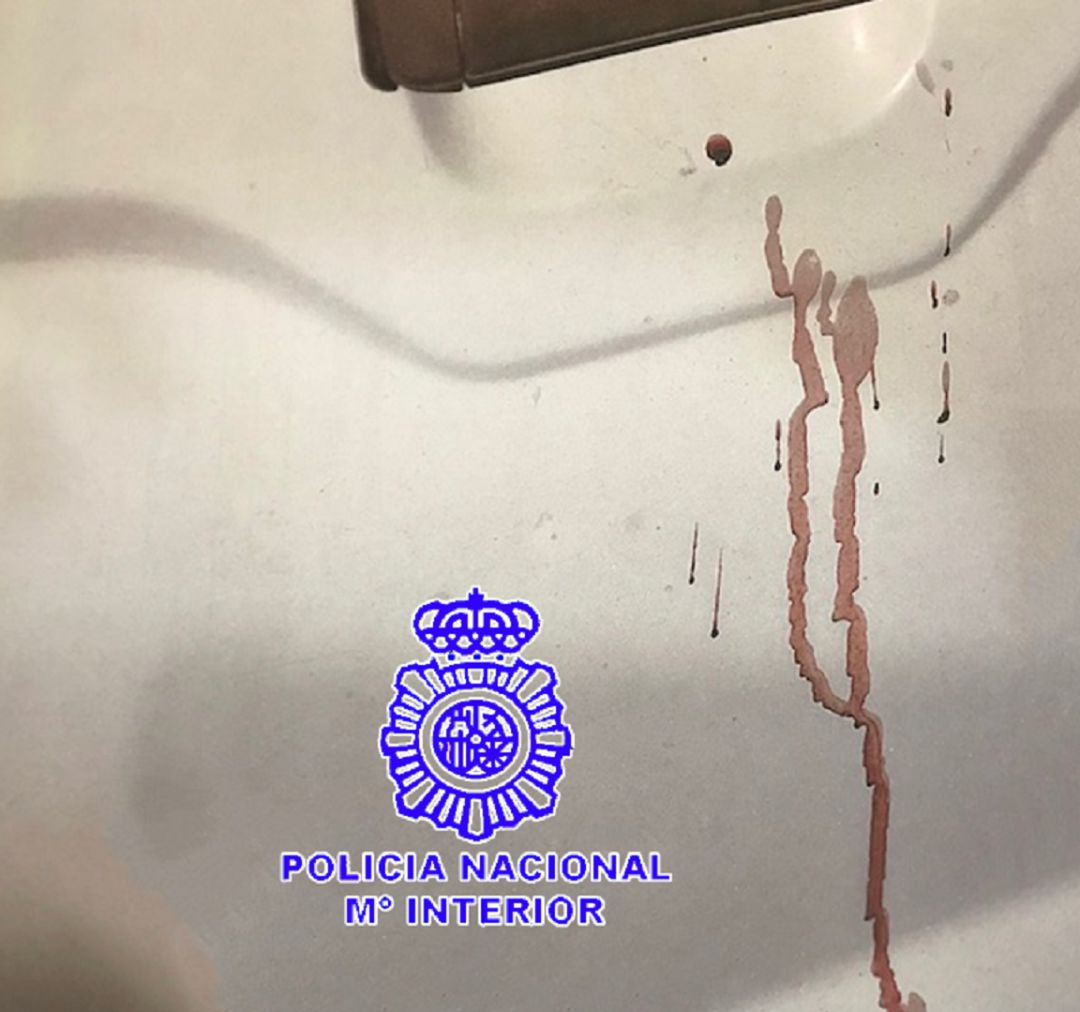 Un rastro de sangre permite detener al presunto autor de varios robos Un rastro de sangre permite detener al presunto autor de varios robos