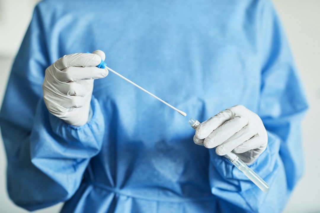 Prueba PCR Prueba PCR