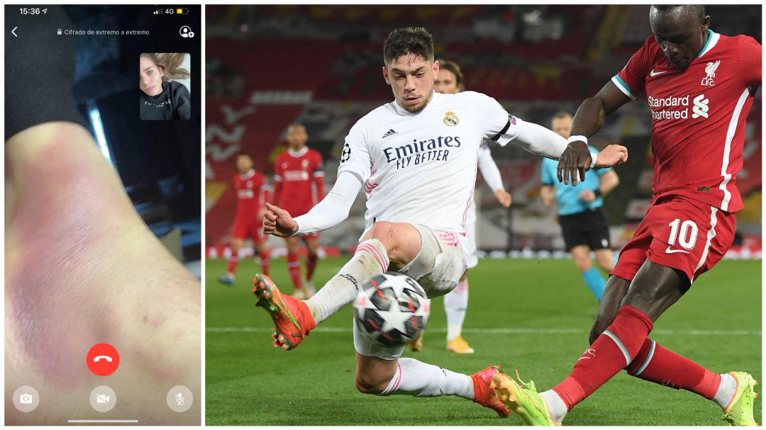 El tobillo de Fede Valverde, antes del partido; y el jugador, en una jugada del encuentro El tobillo de Fede Valverde, antes del partido; y el jugador, en una jugada del encuentro