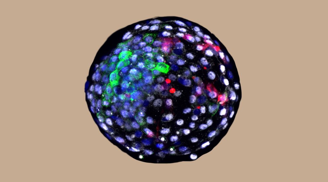 Esta imagen muestra un blastocisto quimera humano-mono. Esta imagen muestra un blastocisto quimera humano-mono.