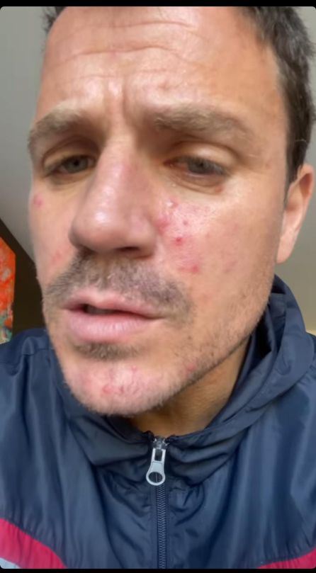 Dani Martín habla sobre su enfermedad en Instagram. Dani Martín habla sobre su enfermedad en Instagram.