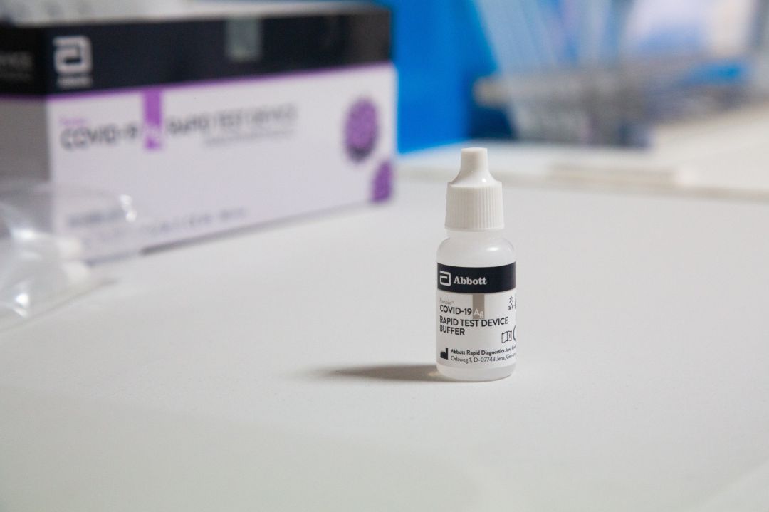 El líquido para un test de antígenos rápido, en un dispositivo de cribado masivo. El líquido para un test de antígenos rápido, en un dispositivo de cribado masivo.