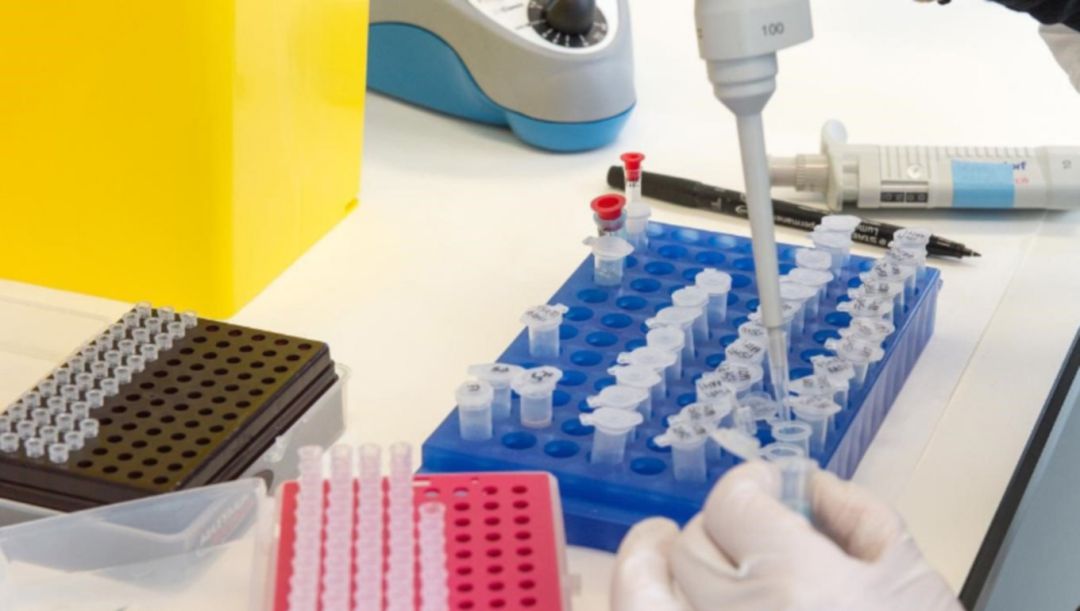 El estudio de IrsiCaixa revela la importancia de los linfocitos T en las personas que no desarrollaron anticuerpos al padecer COVID El estudio de IrsiCaixa revela la importancia de los linfocitos T en las personas que no desarrollaron anticuerpos al padecer COVID