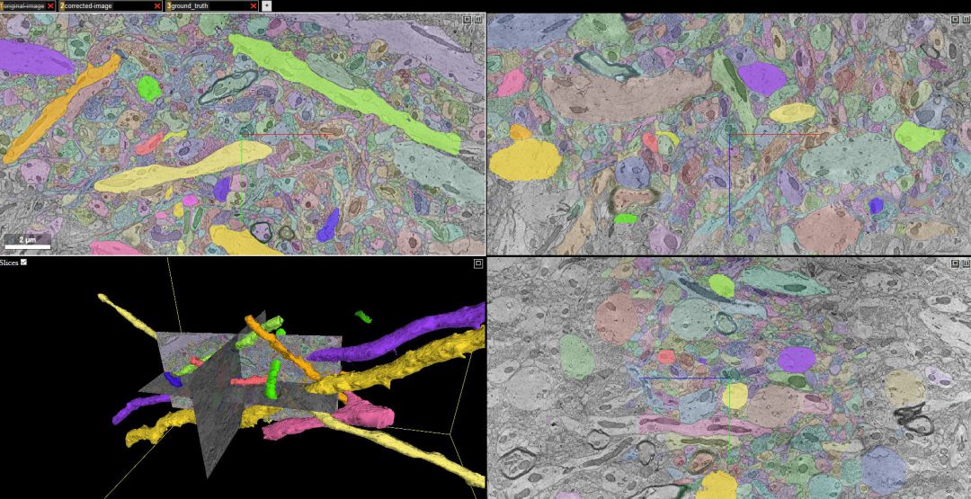 Capturas del proyecto Neuroglancer. Capturas del proyecto Neuroglancer.