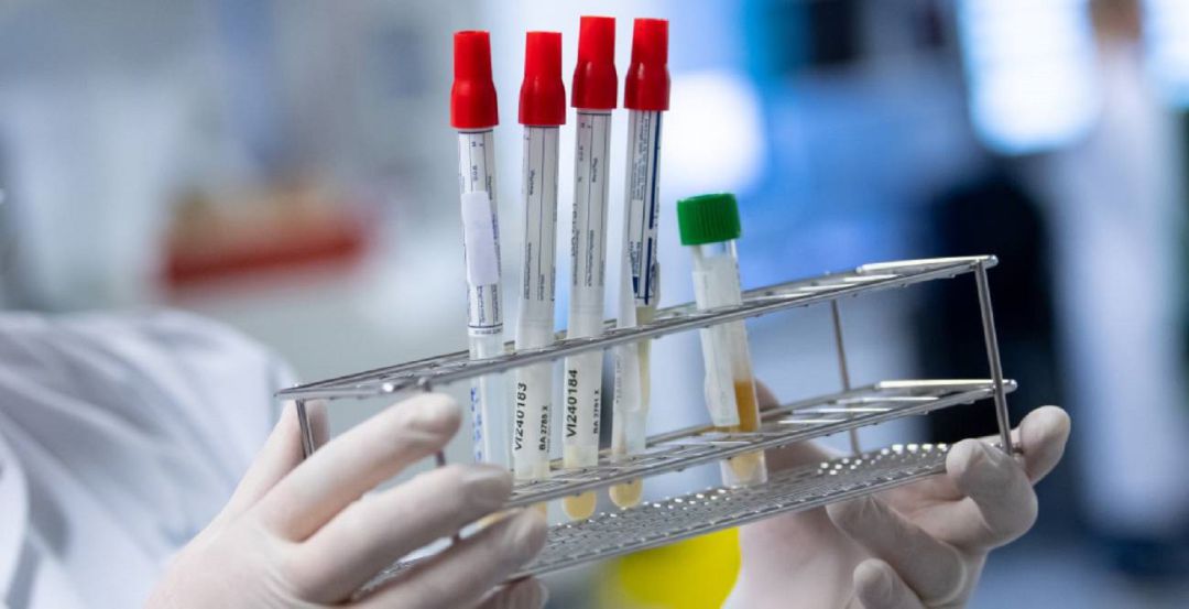 Pruebas PCR Pruebas PCR