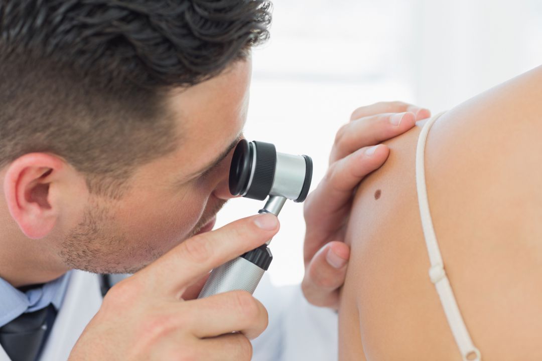 13 de junio, Día Europeo del Cáncer de Piel 13 de junio, Día Europeo del Cáncer de Piel
