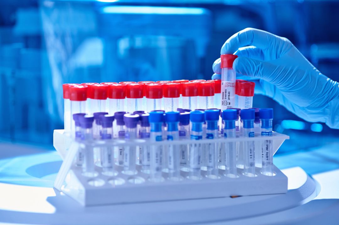 Test PCR Test PCR