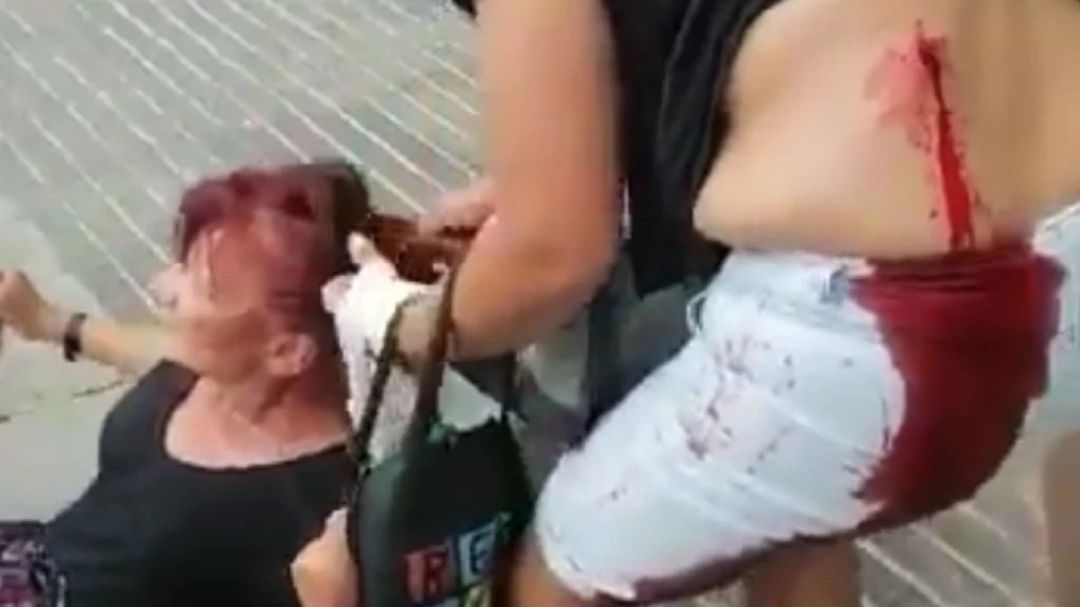 Prisión provisional para la detenida que apuñaló a una inmigrante en la cola de Cáritas Prisión provisional para la detenida que apuñaló a una inmigrante en la cola de Cáritas