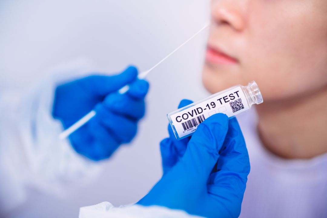 Prueba PCR a un joven para detectar el coronavirus Prueba PCR a un joven para detectar el coronavirus