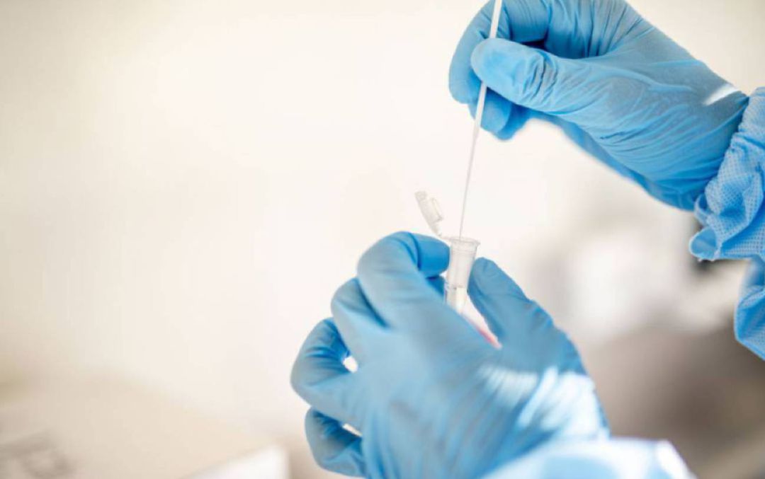 Prueba PCR Prueba PCR
