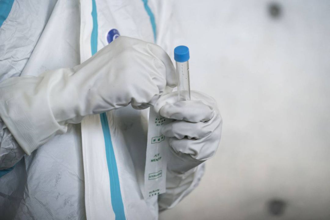 Prueba PCR Prueba PCR