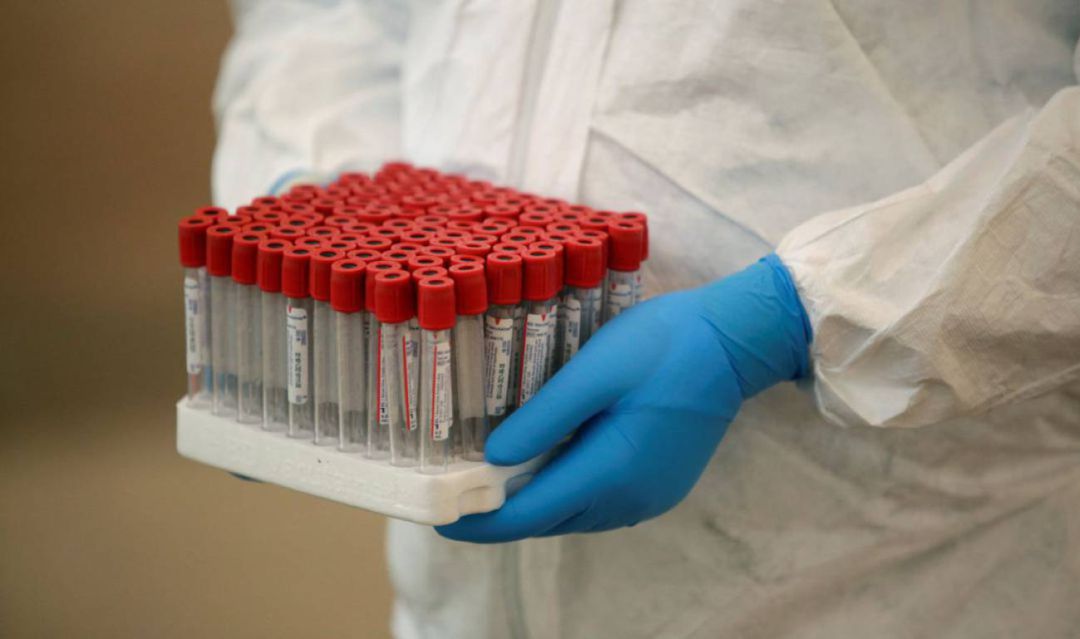 Pruebas PCR Pruebas PCR