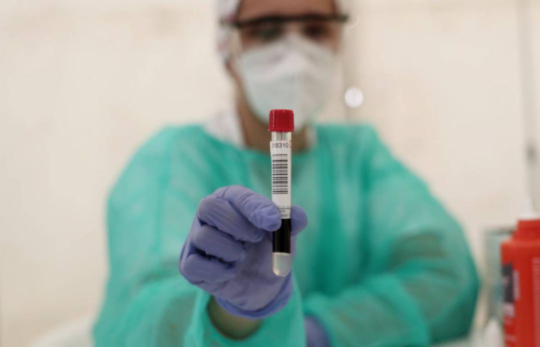 Prueba PCR Prueba PCR