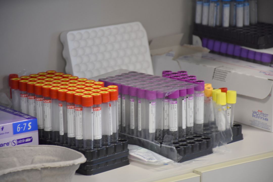 Recipientes para toma de muestras de COVID. Recipientes para toma de muestras de COVID.