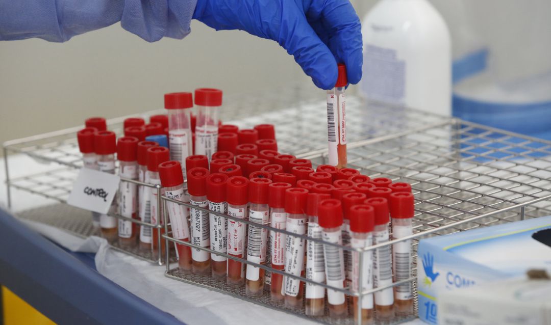 Tubos de pruebas PCR para la detección del COVID-19. Tubos de pruebas PCR para la detección del COVID-19.