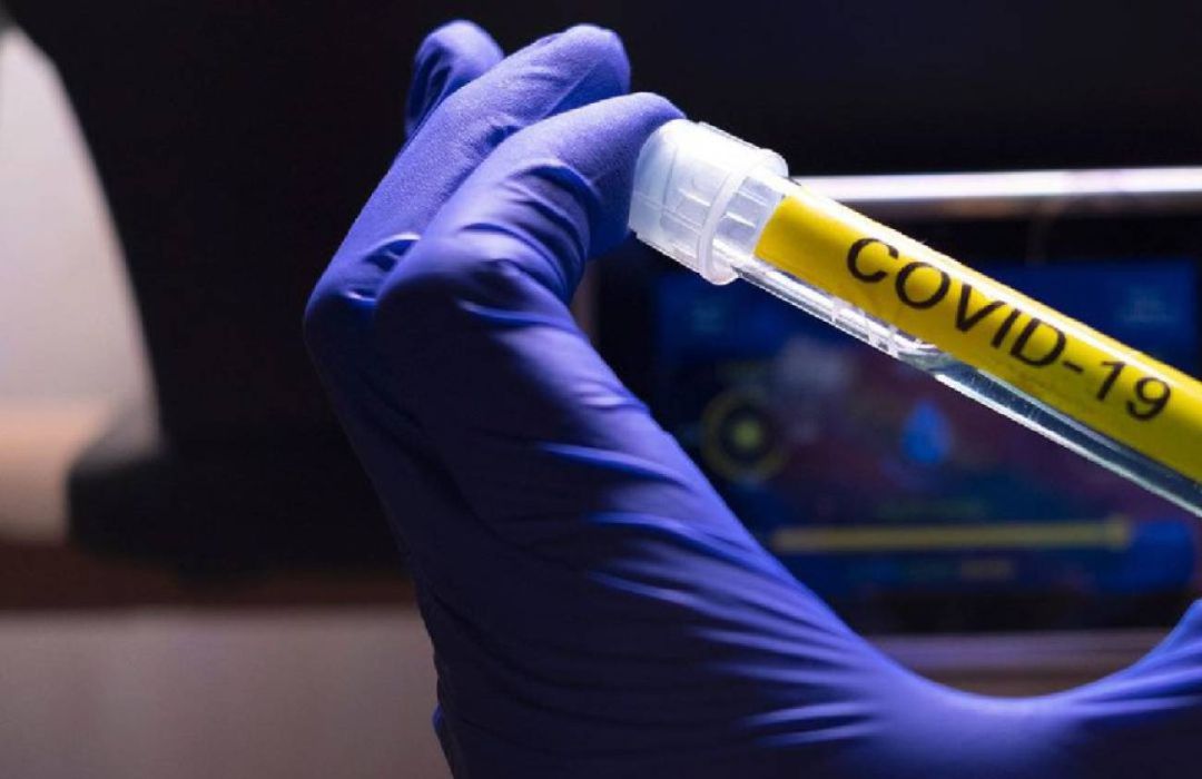 Vial con muestra de Covid-19 Vial con muestra de Covid-19