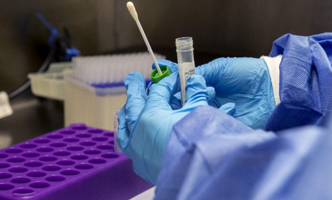 Análisis de un test PCR Análisis de un test PCR