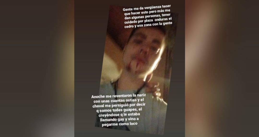 El jóven ha denunciado ante la Policía y en sus redes sociales la agresión El jóven ha denunciado ante la Policía y en sus redes sociales la agresión