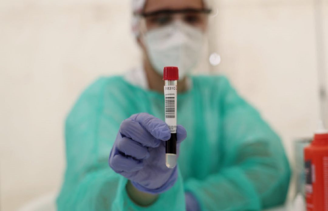 Muestra para hacer la prueba Covid. Muestra para hacer la prueba Covid.
