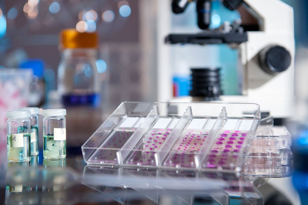 Imagen de archivo de un análisis conocido como biopsia líquida Imagen de archivo de un análisis conocido como biopsia líquida