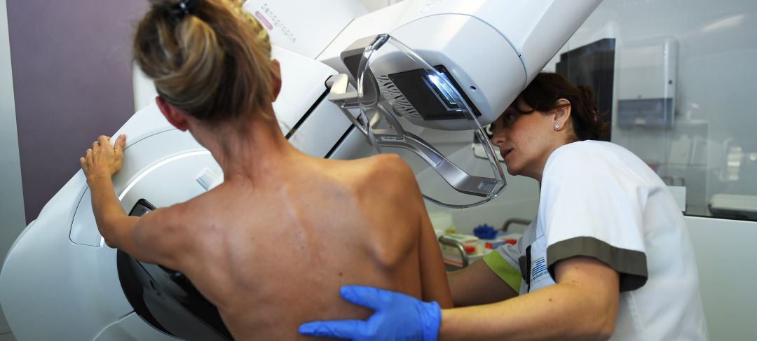 La pandemia afectó "significativamente" a las invitaciones a participar en estos cribados, de manera que en el caso del cáncer de mama apenas se tramitaron la mitad de invitaciones de años anteriores, en concreto, el 54,4 %. La pandemia afectó "significativamente" a las invitaciones a participar en estos cribados, de manera que en el caso del cáncer de mama apenas se tramitaron la mitad de invitaciones de años anteriores, en concreto, el 54,4 %.